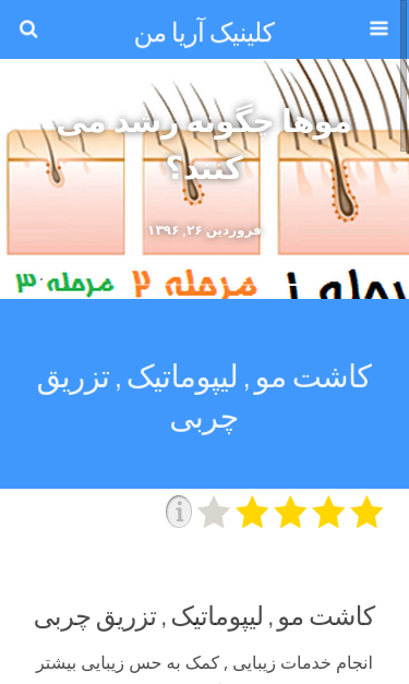 Mobile view